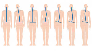 postura corpo